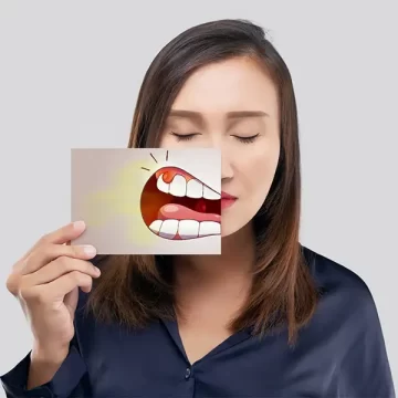 Common Gum Swelling Causes and How to Treat Them