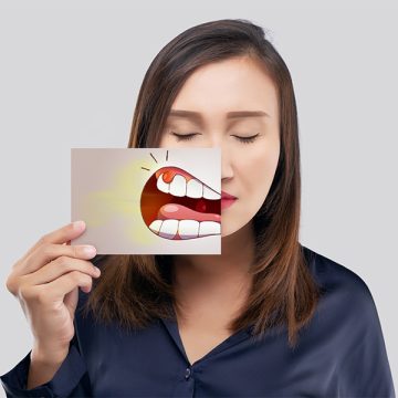 Brown Teeth Stains Near Gums: Expert Tips for Prevention